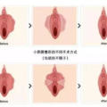 私密整形去世,美丽背后隐藏的生死风险